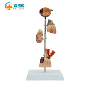 Model Patologi Komplikasi <span class=keywords><strong>Diabetes</strong></span> Bersertifikat CE Mata/Jantung/Ginjal/Selang Pendarahan/Kaki untuk Demonstrasi Pendidikan Medis - Product Image 1