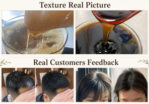 OEM Private Label <strong>Premium</strong> Herbal Plant Extract <strong>Shampoo</strong> Sulfate Free Scalp Care Thickening Hair Care for Daily Salon and Home Use - Product Image 4