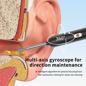 Limpiador de Oídos Visual Inalámbrico 2 en 1, Recortador de Vello Nasal, Compatible con Aplicaciones, Limpiador de Cera de Oídos Inteligente con IA - Product Image 5