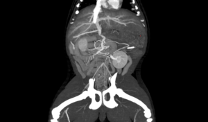Scanner CT Spirale EUR VET, équipement <span class=keywords><strong>médical</strong></span> vétérinaire <span class=keywords><strong>professionnel</strong></span> <span class=keywords><strong>pour</strong></span> hôpital vétérinaire et clinique animale - Product Image 6