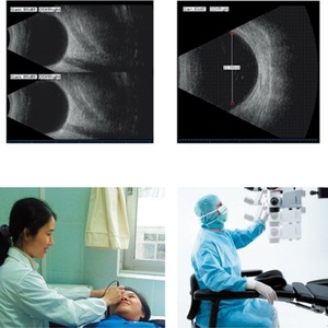 Appareil d'échographie ophtalmique A/B le moins cher pour la pratique ophtalmique, scanner ScanBox EUS500T - Product Image 5