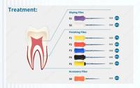 Limas rotativas NiTi de activación de calor Dental de conducto radicular para uso manual