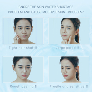 Tonico Essenza Fermentata con Batteri <span class=keywords><strong>Lattici</strong></span>, Estratto di Lievito Fresco Idratante, Dona alla Pelle una Sensazione Ringiovanente, Vendita Calda di Fabbrica - Product Image 4