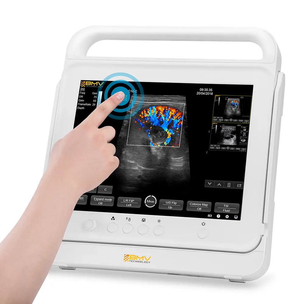 PT50C 수의사 노트북 휴대용 컬러 도플러 초음파 15 인치 터치 스크린 스캔 기계 컬러 초음파