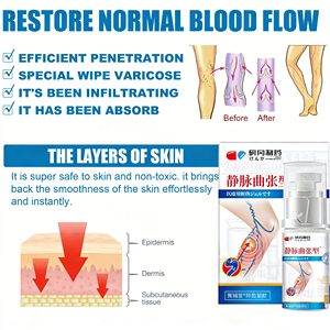 Crema Herbal China para el Alivio de <span class=keywords><strong>las</strong></span> Varices y Arañas Vasculares, Trata la Vasculitis, la Flebitis y <span class=keywords><strong>las</strong></span> Molestias <span class=keywords><strong>en</strong></span> <span class=keywords><strong>las</strong></span> <span class=keywords><strong>Piernas</strong></span> - Product Image 5