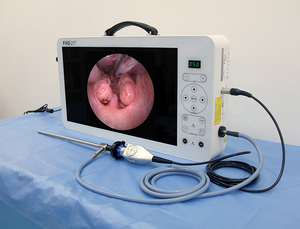 Nueva Cámara endoscópica Full HD portátil médica <span class=keywords><strong>de</strong></span> fábrica <span class=keywords><strong>Shrek</strong></span> sistema 4 en <span class=keywords><strong>1</strong></span> con monitor <span class=keywords><strong>de</strong></span> 21 pulgadas para cirugía laparoscópica - Product Image 5