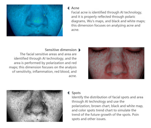 Nouvel Arrivage : Machine d'<span class=keywords><strong>analyse</strong></span> cutanée Pro-Sumer améliorée, Scanner d'<span class=keywords><strong>analyse</strong></span> faciale IA pour un diagnostic cutané 3D avancé et professionnel - Product Image 4