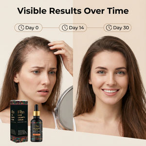 Sérum Capilar Vegetariano <span class=keywords><strong>Herbal</strong></span> Caseiro da Nossa Marca, Óleo de Crescimento Capilar de Rícino e Alecrim, Líquido Natural Puro para Crescimento Capilar - Product Image 5