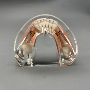 แบบจำลองการใส่รากฟันเทียมแบบถอดได้สำหรับการสาธิตทางทันตกรรมและการสื่อสารกับผู้ป่วย - Product Image 5