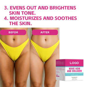 Biểu Tượng Tùy Chỉnh 50G Phụ Nữ Nách Làm Trắng Collagen Kojic Axit Nách Kem - Product Image 4