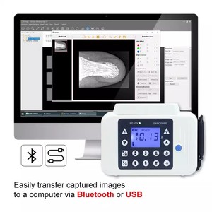 Màn hình cảm ứng LCD Thiết bị cầm tay cầm tay kết hợp cảm biến tia X Thiết bị thú y nha khoa - Product Image 3