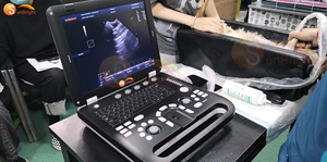 Ecógrafo Doppler Color Veterinario Profesional JM-906A HD para Detección <span class=keywords><strong>de</strong></span> <span class=keywords><strong>Enfermedades</strong></span> en Animales <span class=keywords><strong>de</strong></span> Granja - Product Image 4
