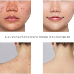 Jabón Artesanal de Leche de Cabra con Aceites Esenciales y Sal Marina Orgánica <span class=keywords><strong>Natural</strong></span> OEM, Blanqueador, para Eliminar el Acné Profundo de la Piel - Product Image 4