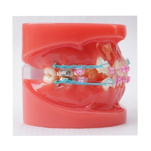 Modelo de ortodoncia dental Typodont dientes 24 piezas con soportes de cerámica - Product Image 2