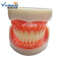 Modelo de Dientes Humanos, Modelo de Implante de Dentadura Completa, Modelo Educativo de Ciencias Médicas