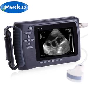 Scanner à ultrasons portable Medco 3,5 MHz pour usage vétérinaire, appareil d'imagerie haute définition - Product Image 1