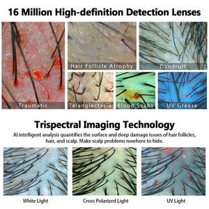 Analyseur de cheveux intelligent AI, analyseur de peau, analyse du cuir chevelu, soin du cuir chevelu avec stockage de données cloud, machine d'analyse des cheveux - Product Image 4