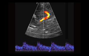 Échographe Doppler Couleur Mindary Z.One PRO sur Chariot pour Usage Vétérinaire avec Échographie et Diagnostic Ultrasonore Haute Définition - Product Image 3