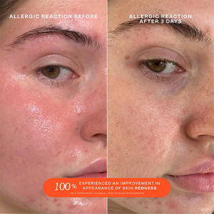 El aerosol facial de ácido hipocloroso de rescate diario SOS de etiqueta privada para pieles sensibles ayuda a reducir el enrojecimiento por brotes de irritación - Product Image 5