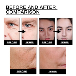 <span class=keywords><strong>Set</strong></span> di Cura della Pelle Maschile East Moon 100% Naturale, Sbiancante, Anti-Rughe, Idratante, con Siero e Crema per il Viso, Etichetta Privata - Product Image 6