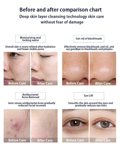 Nueva Máquina de Belleza Hydra 14 en 1 2026, Analizador Profesional de Cuidado Facial con Hidrodermoabrasión y Diamante para Salón de Belleza y Spa, de Primera Categoría - Product Image 6