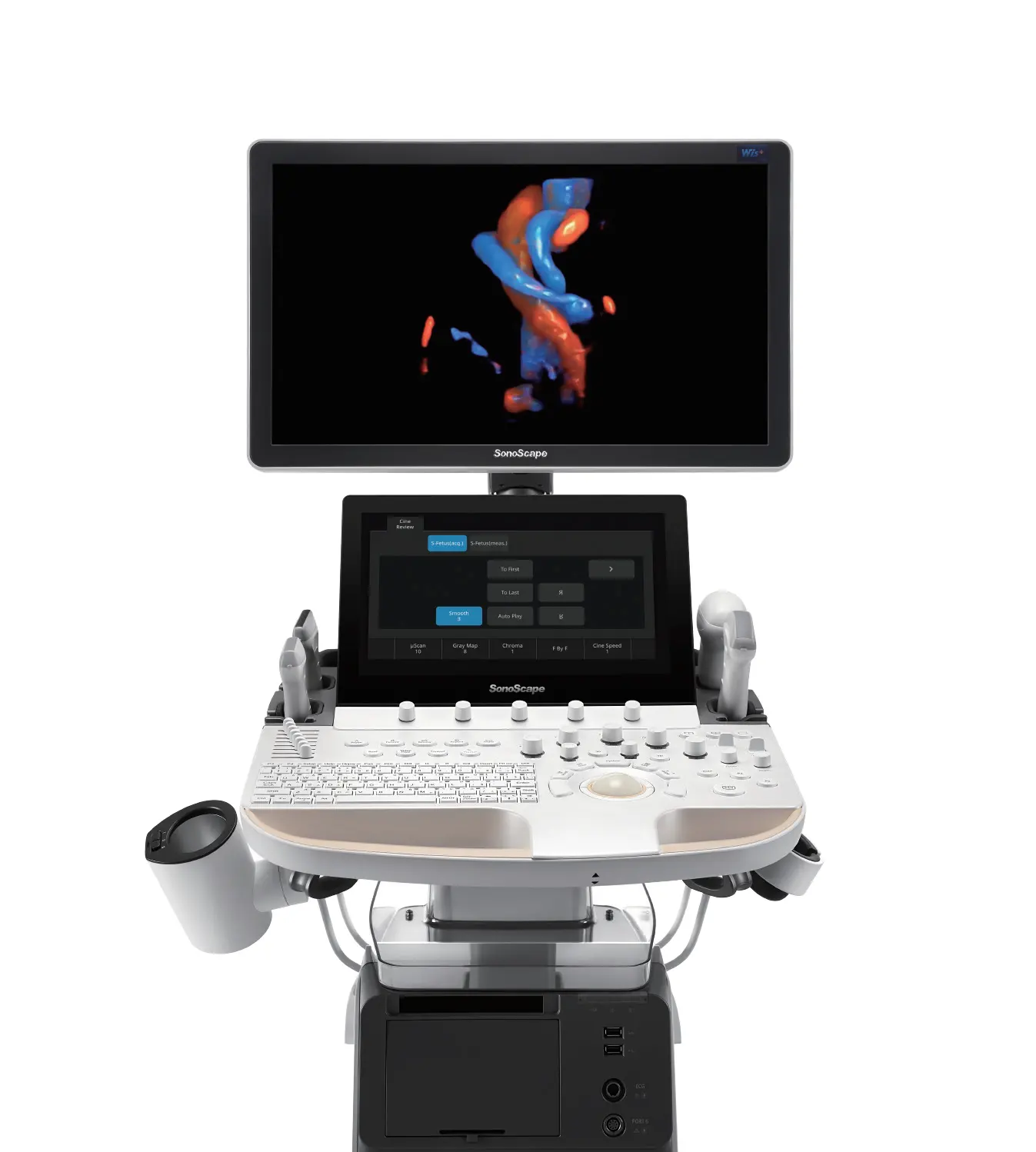 P60 exp4D 5D超音波スキャナー超音波検査エコーマシン超音波検査超音波診断医療病院機器