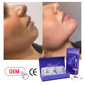 Acide hyaluronique réticulé de qualité clinique 1 ml – Remplisseur profond pour le rajeunissement et la restauration du volume du visage - Product Image 1