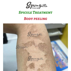 Produit de <span class=keywords><strong>peeling</strong></span> pour la peau précieuse, boîte de soin de la peau Spicule pour le <span class=keywords><strong>peeling</strong></span> corporel - Product Image 5