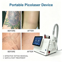 Appareil de rajeunissement cutané picoseconde / Appareil de raffinage de la peau pour salon et usage domestique / Machine esthétique pour le soin des pigments et des tatouages / Soins de la peau