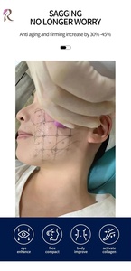 Máquina de Radiofrecuencia Monopolar Oligio de <span class=keywords><strong>Wontech</strong></span> Corea de 6.78MHz, Antienvejecimiento, Estiramiento Facial, Reafirmación de la Piel, Eliminación de Arrugas - Product Image 5