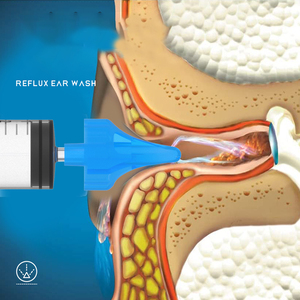 <span class=keywords><strong>Seringue</strong></span> de nettoyage d'oreilles en silicone à triple flux pour nourrissons, dispositif sûr pour le <span class=keywords><strong>lavage</strong></span> des oreilles et du <span class=keywords><strong>nez</strong></span>, produit de soin pour bébés - Product Image 2
