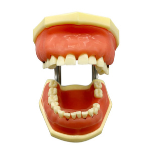Modèle pour la démonstration et la pratique de la mise à l'échelle du calcul pathologique parodontal - Product Image 1