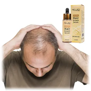 निजी लेबल प्राकृतिक कार्बनिक पौष्टिक Mens विरोधी बालों के झड़ने के लिए तेल Ginseng तेजी से बाल विकास सीरम बाल बढ़ने