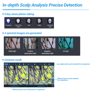 8 개 언어의 신상품 T5 AI 지능형 모발 및 두피 분석 두피 분석기 - Product Image 4