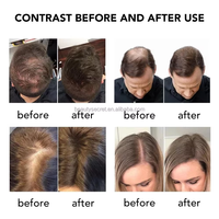 Poudre Coiffante de Qualité en Gros à Base de Fibres de Protéine pour le Renforcement des Cheveux. Soin Capillaire Épaississant, Spray Épaississant Cheveux Naturellement Colorés