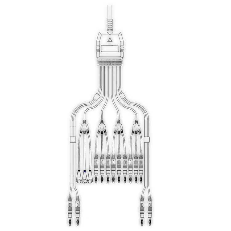Electrocardiograma digital portátil plegable de 5.6 pulgadas con aspiración digital de 3 canales