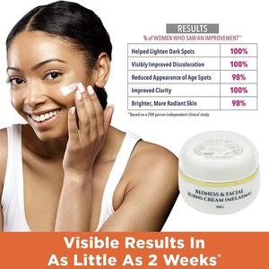 Crema Sbiancante 5D Gluta per Rimozione Melasma, Trattamento per Rossori e Scottature Facciali, Rimozione Macchie Scure, Anti-Macchie, Schiarimento Lentiggini - Product Image 5