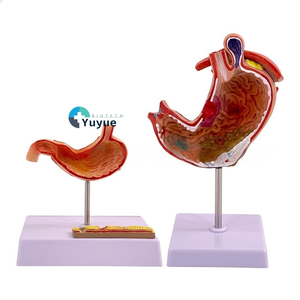 Modelo <span class=keywords><strong>de</strong></span> anatomía educativa <span class=keywords><strong>de</strong></span> Gastroenterología, sección coronal ampliada <span class=keywords><strong>de</strong></span> PVC, perforación patológica del estómago para la ciencia médica - Product Image 1