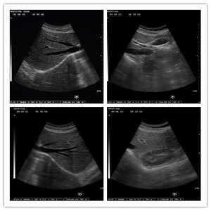 Penjualan terlaris SUN-806G <span class=keywords><strong>ultrasound</strong></span> medis BW <span class=keywords><strong>Ultrasound</strong></span> 2D ginekologi notebook kehamilan mesin <span class=keywords><strong>ultrasound</strong></span> USG - Product Image 5