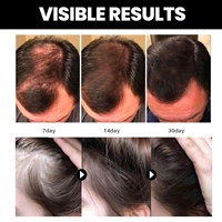 La coutume favorise la force des cheveux traitement de la perte de cheveux anti-cassure huile de batana organique pour la croissance des cheveux