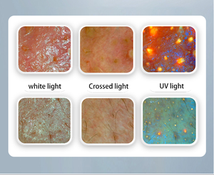 Analizador de Piel Digital Profesional X5 <span class=keywords><strong>Pro</strong></span> con IA, Análisis <span class=keywords><strong>Facial</strong></span>/Capilar de Cinco Dimensiones, Dispositivo de Prueba de Microflora con Luz UV - Product Image 4