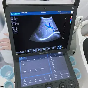 Echography medis mesin Ultrasound portabel 3D 4D Promosi sonosape S9 - Product Image 6