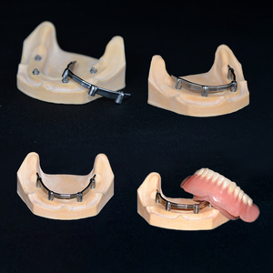 Implante Dental de Titanio Personalizado <span class=keywords><strong>CAD</strong></span> CAM de Fábrica, Accesorios para Implantes Dentales, Sistema de Restauración de Implantes, Implante Soportado - Product Image 4