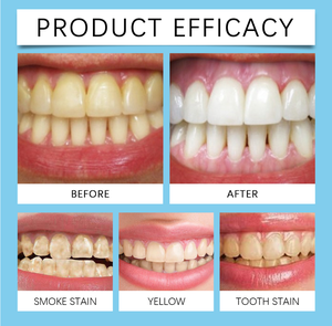 Mousse nettoyante buccale blanchissante aux herbes de haute qualité 50 ml – Éliminateur de taches dentaires – Soin haleine fraîche – Usage domestique - Product Image 3