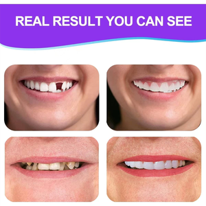 Prothèses dentaires supérieures/inférieures en silicone, facettes dentaires <span class=keywords><strong>pour</strong></span> un sourire parfait, outils d'hygiène buccale, dents cosmétiques - Product Image 6