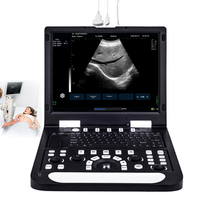 Appareils médicaux à ultrasons RS-N60, portables, 2D, électriques, noir et blanc, pour vétérinaires - Product Image 1