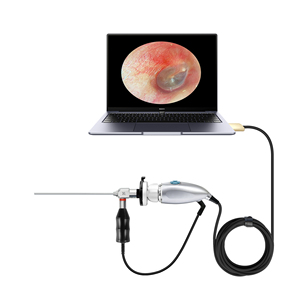 Endoscopio Veterinario USB 1080P con Cámara de Endoscopia de Luz Fría, Aumento de 6x y Función de Congelación de Imagen para Inspección Animal - Product Image 2