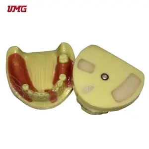 Tandheelkundige Leermiddelen Dental Implant Training Model