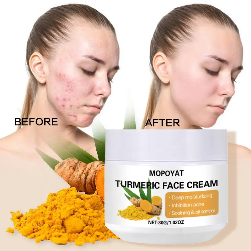 MOPOYAT Wholesale Turmeric Face Cream for Women Brightening, Anti Aging, Hydrating, Skin Wrinkle Cream, Dark Spot Corrector