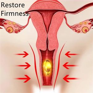 Vaginale verstevigingscapsules, vrouwelijke yoni-producten, yoni-klempillen - Product Image 4